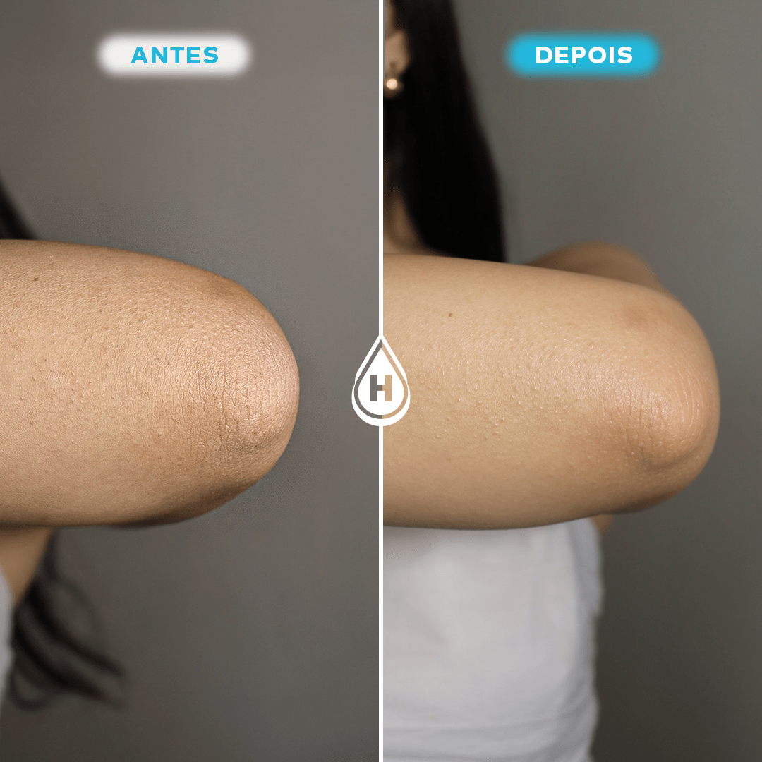 Loção Hidratante Corporal 200ml - Para Presentear - Hidratei